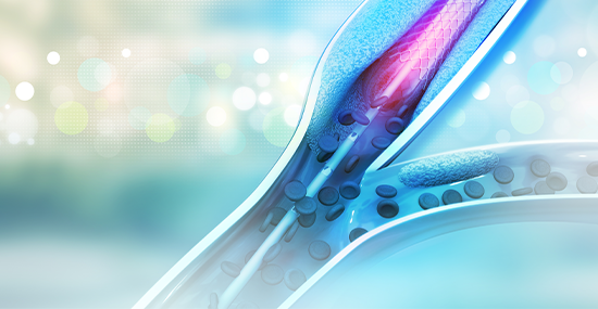 stent or catheter used in surgeries